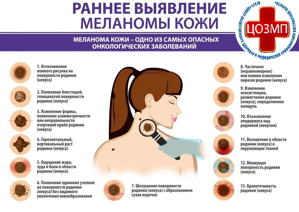 Профилактика кожных заболеваний