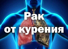 20 ноября 2025 года «Всемирный день некурения и профилактики онкологических заболеваний»